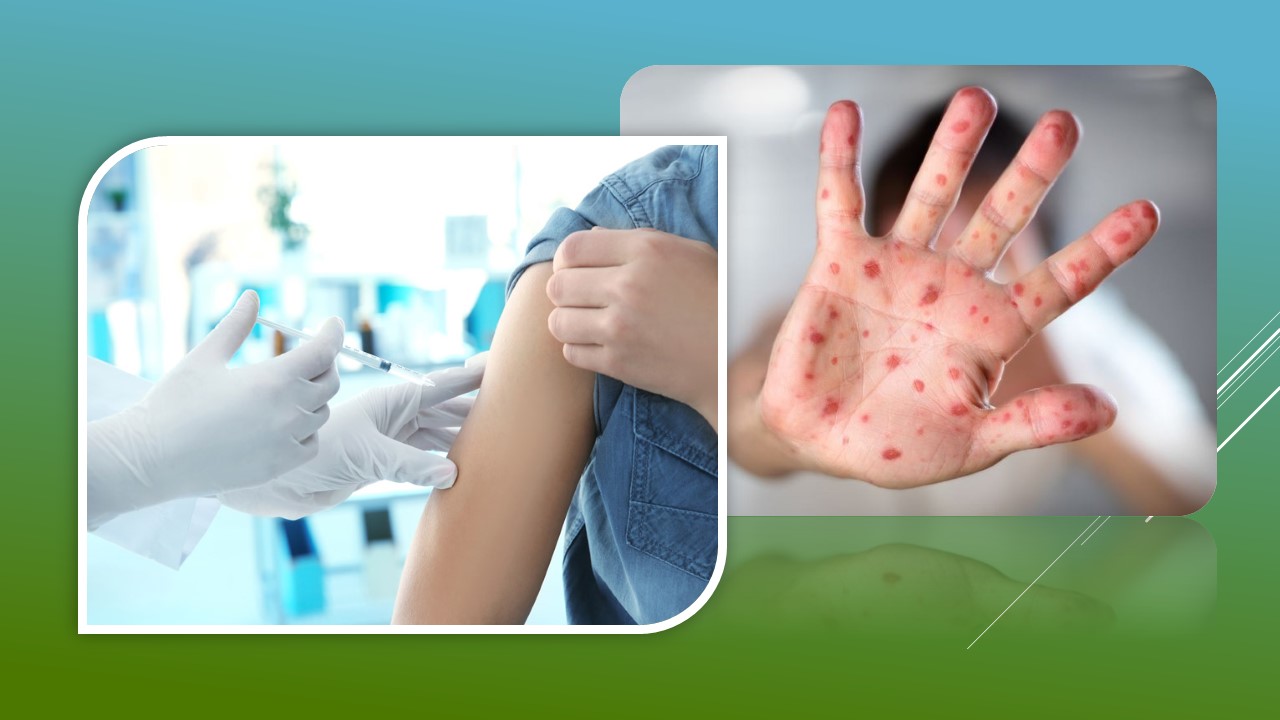 Ви зараз переглядаєте Захворювання на кір зростає: дітям до 17 років необхідне щеплення!