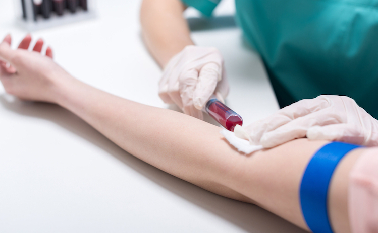 Ви зараз переглядаєте У Міжнародний тиждень тестування на ВІЛ Петропавлівська лікарня запрошує всіх охочих здати аналізи